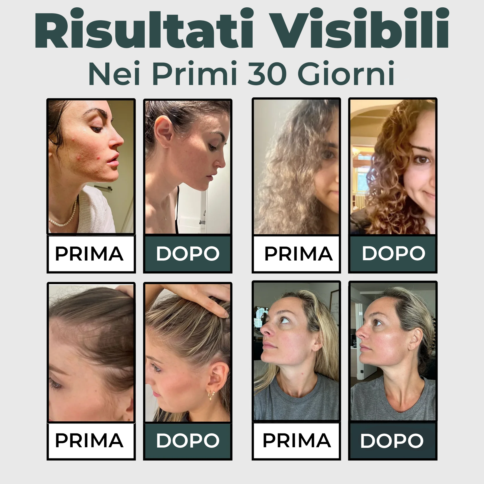 Salva la tua pelle e i tuoi Capelli dal disastro con Life™ 